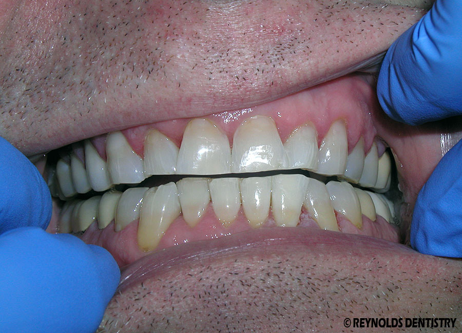 Reynolds Dentistry